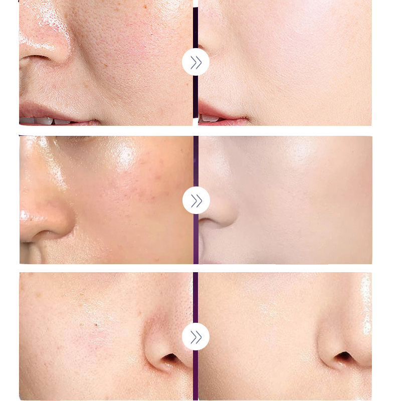 Luxury Noble Lady Cream Pearl  - Luxury Skincare Anti Aging บทวิจารณ์และราคา